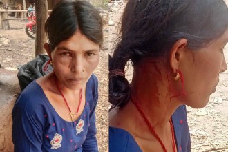 बैतडीको शिवनाथमा चितुवाको आक्रमणबाट एक महिला घाइते 