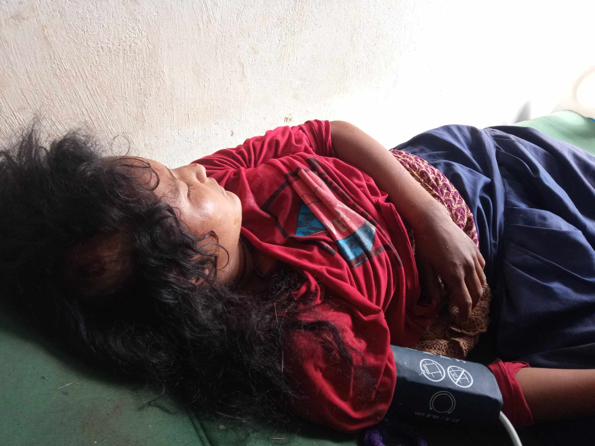 बैतडीमा चितुवाको आक्रमणबाट घाइते किशोरी धनगढी रेफर  