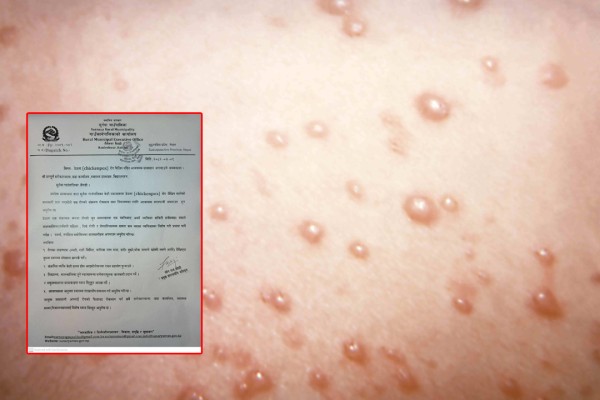 बैतडीको सुर्नयाका केही ठाउँमा ठेउला रोग देखियो, सतर्कता अपनाउन आग्रह 