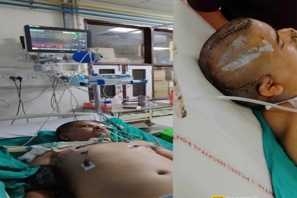 भारतमा दुर्घटना हुँदा बैतडीका विष्टको अवस्था गम्भीर, आर्थिक अभावले उपचारमा समस्या