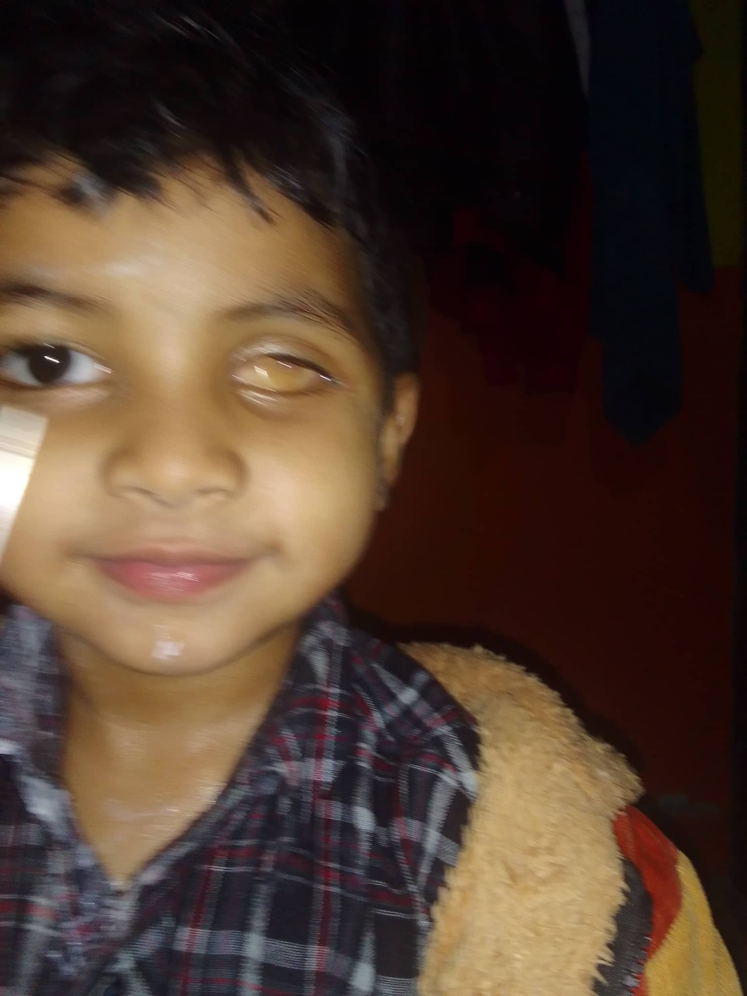 बैतडीका हिमांशुको आँखामा ट्यूमर, खर्च नहुँदा उपचरमा समस्या