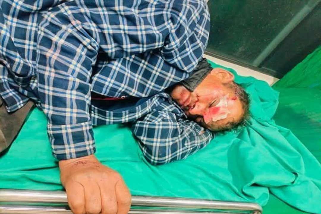 बैतडीमा मोटरसाइकल दुर्घटना हुँदा वडा अध्यक्ष घाइते