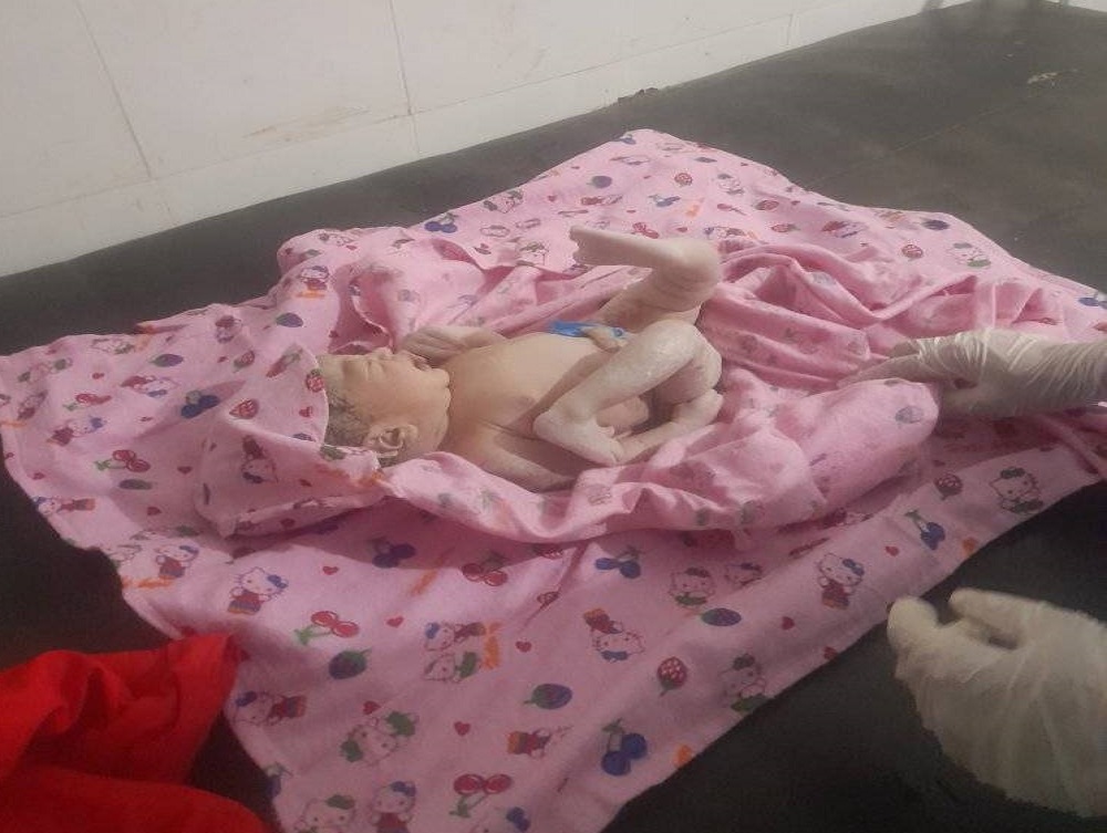 बैतडीमा जन्मियो असाधारण शिशु 