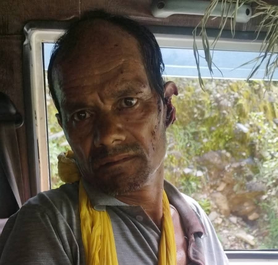 भालुको आक्रमणबाट दार्चुलामा एक जना घाइते