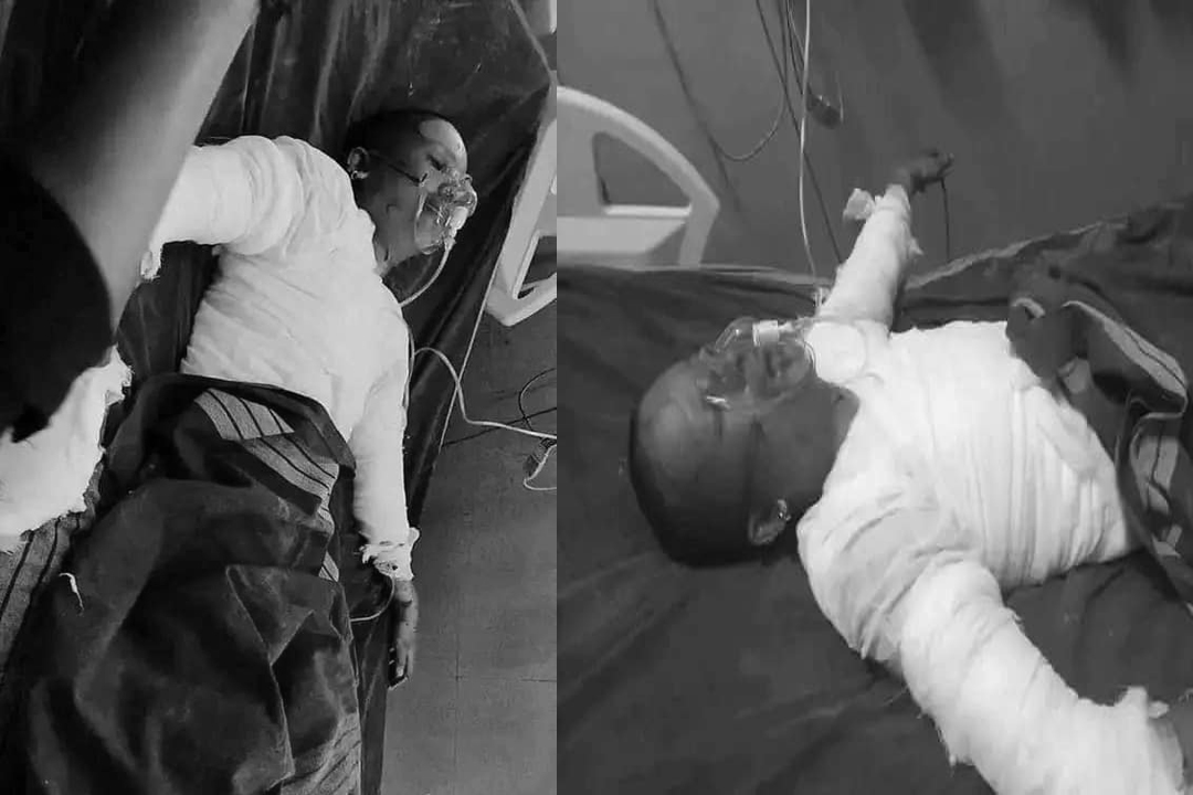 खाना पकाउने ग्यास लिक भएर आगलागी हुँदा बैतडीका एक युवकको मृत्यु